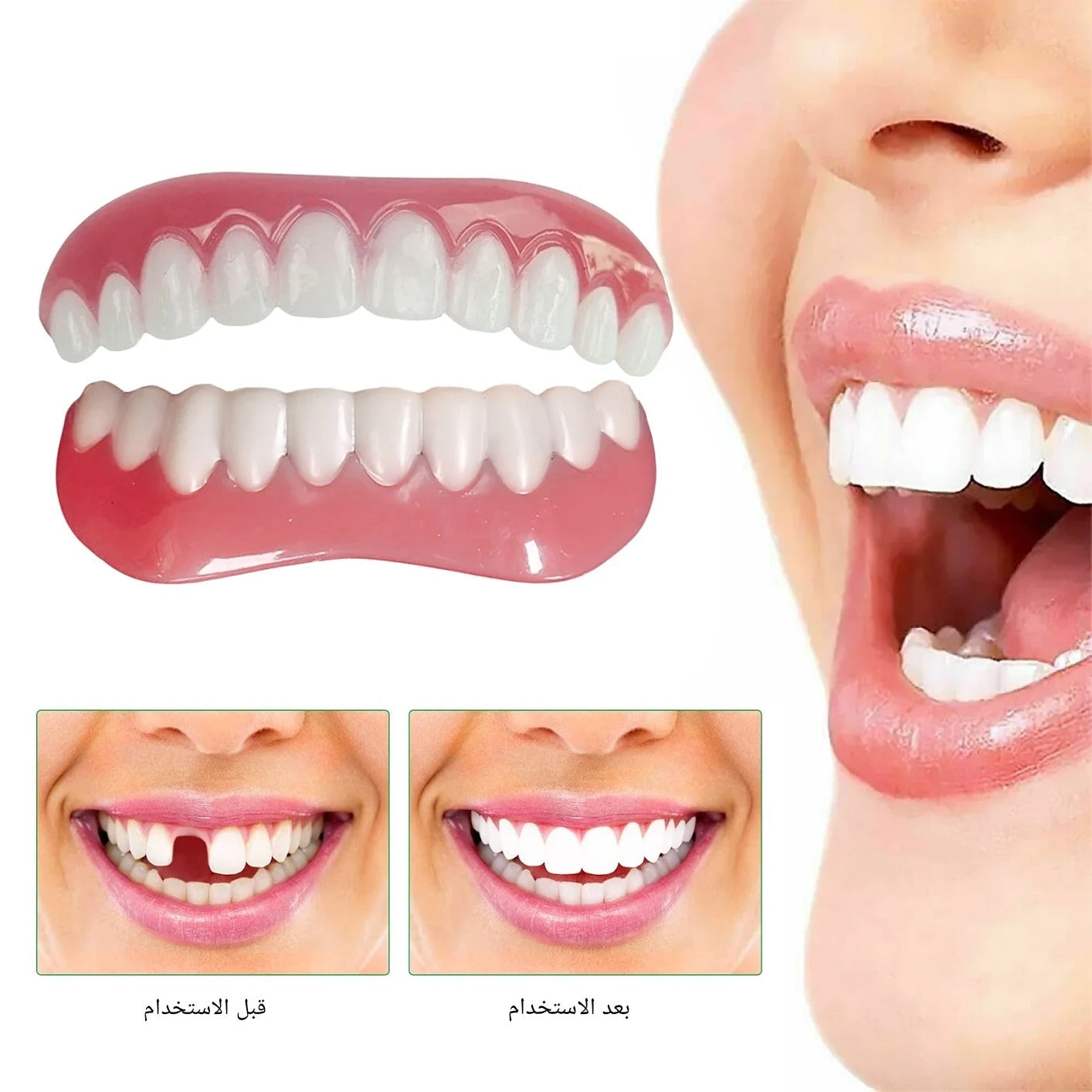 Hollywood smile